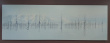 Bilde på aluminiumsplate 300x100cm - 2 / 4
